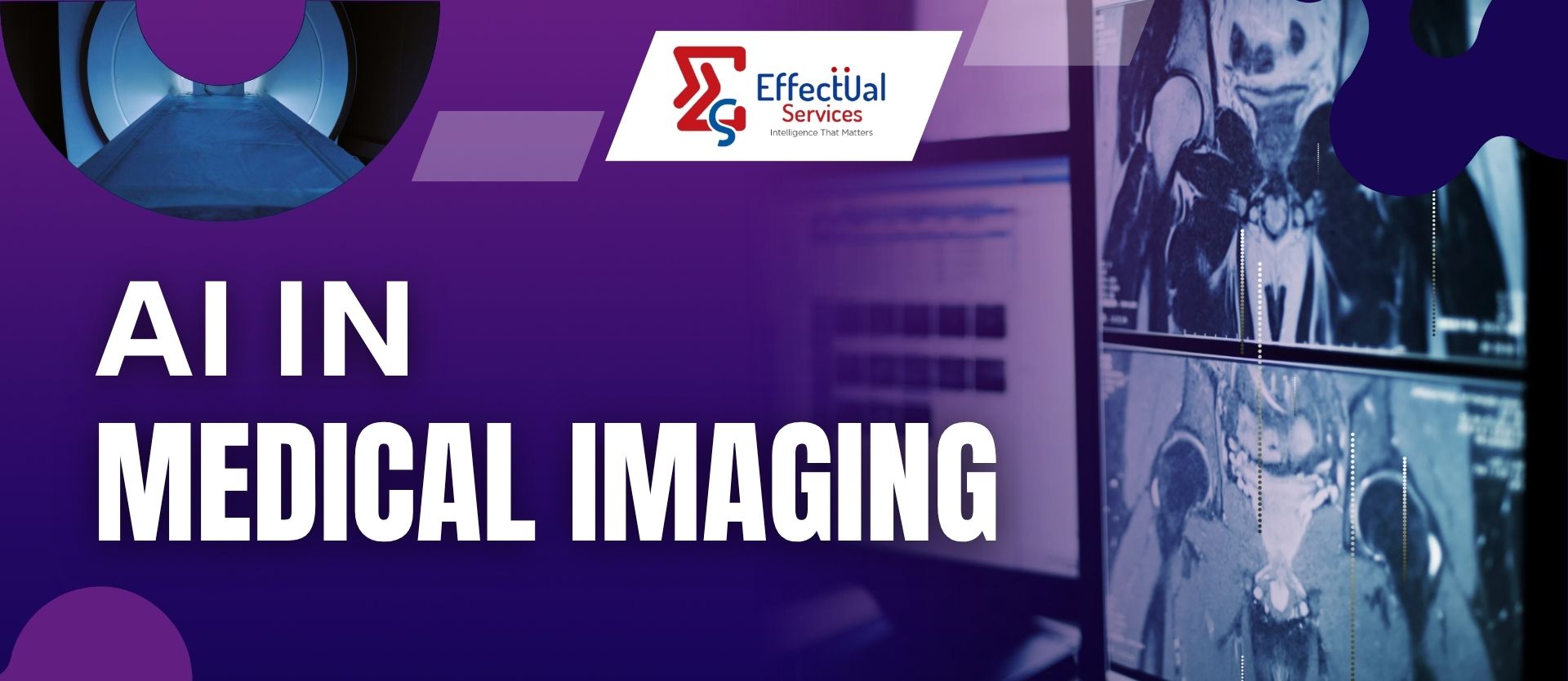 Artificial Intelligence in Medical Imaging