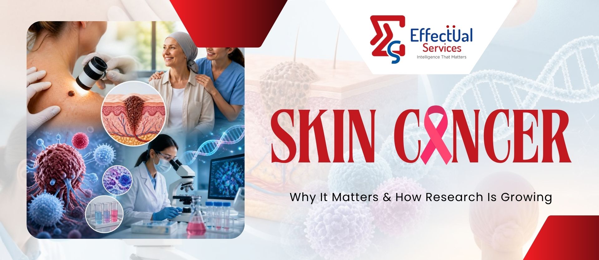 Skin Cancer Treatment: Why It Matters and How Research Is Growing